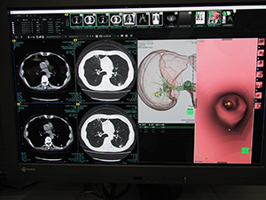 SYNAPSE 5ではSYNAPSE VINCENTとの連携などを強化