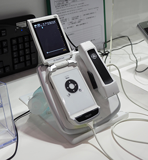 プライマリーケア領域で有用なポケットサイズ超音波診断装置「Vscan」