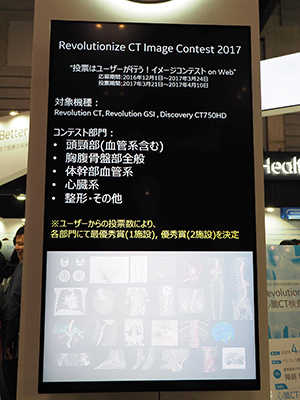 「Revolutionize CT Image Contest 2017」の紹介パネル