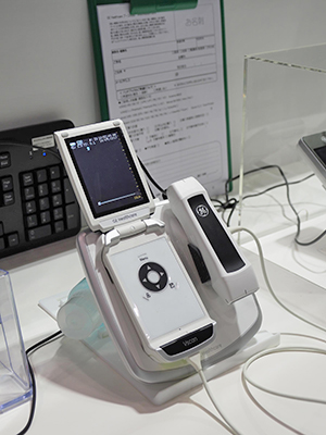 救急領域や在宅医療でも威力を発揮する「Vscan」