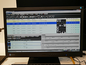 「iRad-QA」はリスト画面でサムネイル表示が可能