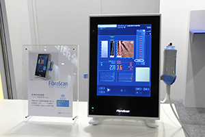 従来製品から30kgの軽量化がされた「フィブロスキャン530コンパクト」