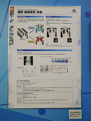 今回，技術展示を行った「胸部動態解析技術」（薬機法未承認）