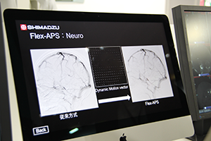 DASのアーチファクトを自動で補正する“Flex-APS”