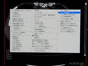 右クリックメニューでZiostation2のアプリケーションを直接起動できるほかスピードも向上