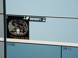 所見からキー画像にテキストをドラッグアンドドロップでタグ付け可能