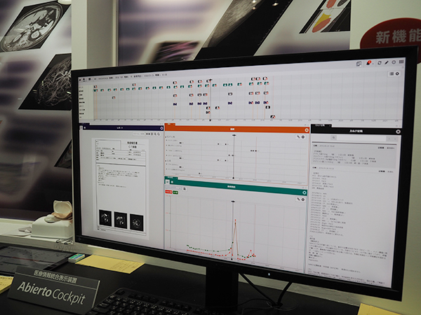 患者を中心に時間軸の情報参照を可能にする「Abierto Cockpit」