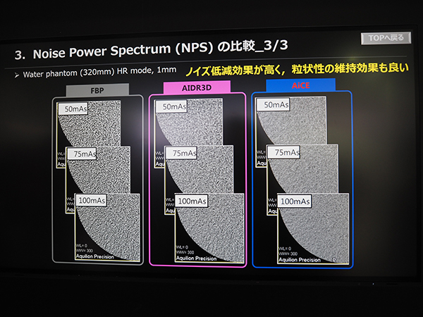 AIDR 3Dなどに比べて粒状性を維持しながらノイズの低減が可能