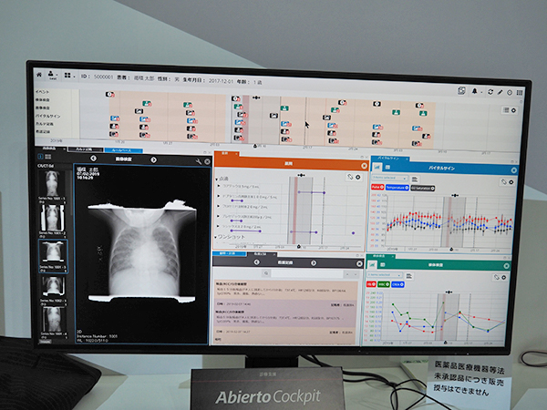 さまざまな患者情報を統合的に表示，参照できる医療情報統合ビューア「Abierto Cockpit」