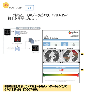 AI解析サービス　AI-ORCHESTA