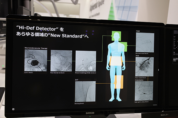 12インチ×16インチのHi-Def Detectorの登場で適用領域が拡大