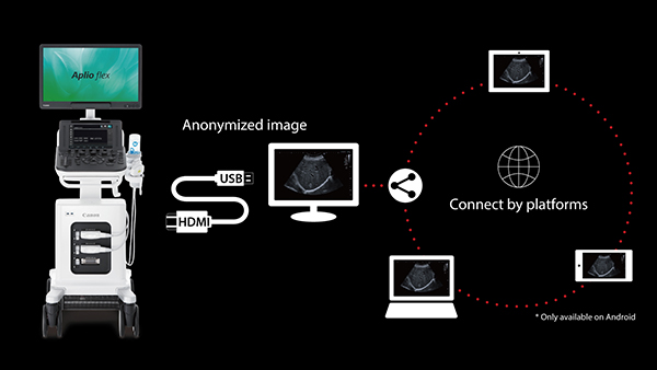 ApliGateのネットワーク構成概念図