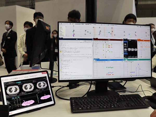 医療情報統合ビューワ「Abierto Cockpit」と画像解析ワークステーション「Vitrea」による治療効果判定のワークフロー改善を紹介