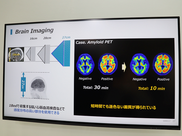 高感度検出器により約10分でアミロイドPETを撮像可能