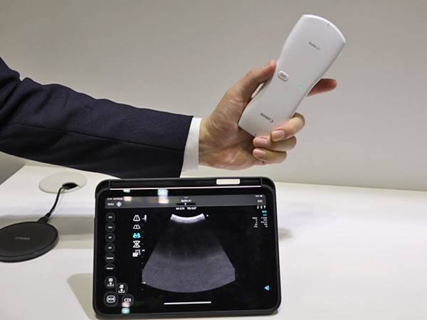 多彩なシーンで活用できるデュアルプローブの携帯型超音波診断装置「Aplio air」 多彩なシーンで活用できるデュアルプローブの携帯型超音波診断装置「Aplio air」