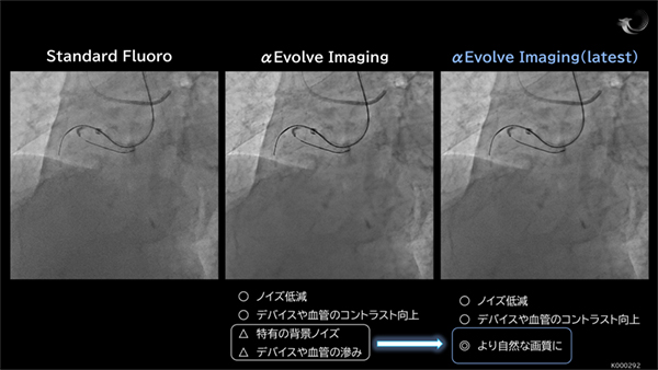 リアルタイム画像処理「αEvolve Imaging」が第二世代に進化 リアルタイム画像処理「αEvolve Imaging」が第二世代に進化