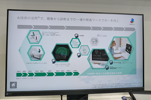 AI技術を活用して撮像から診断までのワークフローをサポートして効率的な検査を支援 AI技術を活用して撮像から診断までのワークフローをサポートして効率的な検査を支援