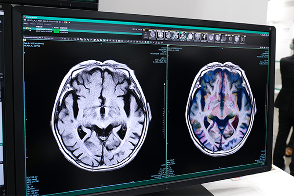 SYNAPSE SAI viewerの頭部SAIフィルタと脳区域ラベリング SYNAPSE SAI viewerの頭部SAIフィルタと脳区域ラベリング