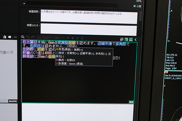 「読影レポート構造化AI」で平文で入力した所見を構造化してデータベース化 「読影レポート構造化AI」で平文で入力した所見を構造化してデータベース化