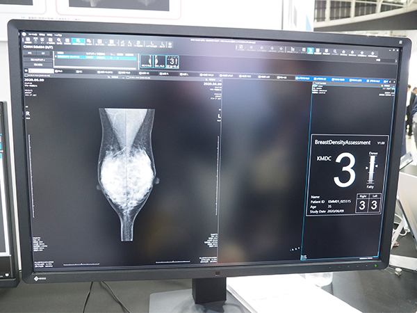 「Breast Density Assessment(Bda)」で乳房構成を4分類で表示する。 「Breast Density Assessment(Bda)」で乳房構成を4分類で表示する。