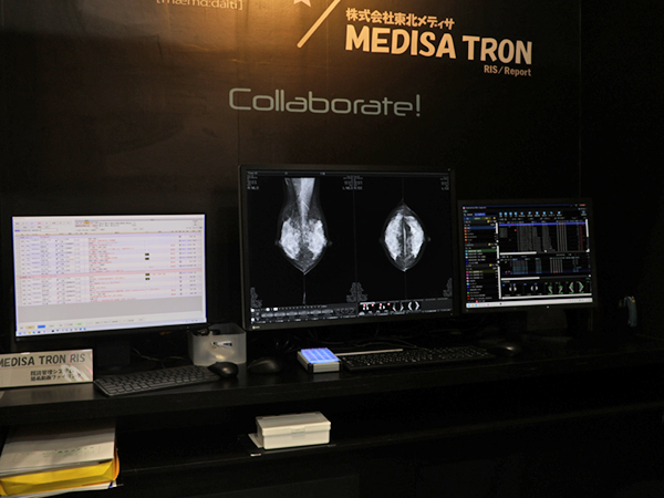 来場者は,EIZO,バルコ,JVCケンウッドのディスプレイを使った展示でmammoditeの操作性を体験 来場者は,EIZO,バルコ,JVCケンウッドのディスプレイを使った展示でmammoditeの操作性を体験