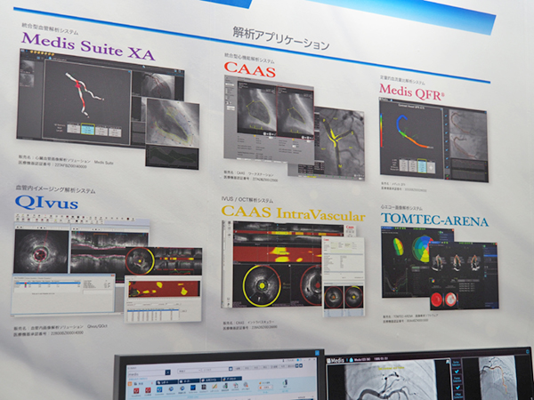 循環器領域の各解析アプリケーションのデモンストレーション展示 循環器領域の各解析アプリケーションのデモンストレーション展示