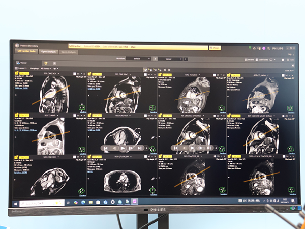 バックグラウンドでトレース解析した画像を一覧表示する「MR Cardiac Suite」のビューワ機能 バックグラウンドでトレース解析した画像を一覧表示する「MR Cardiac Suite」のビューワ機能