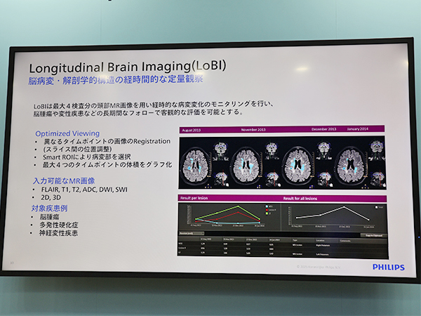 3D FLAIR*も作成できる「Longitudinal Brain Imaging(LoBI)」 3D FLAIR*も作成できる「Longitudinal Brain Imaging(LoBI)」