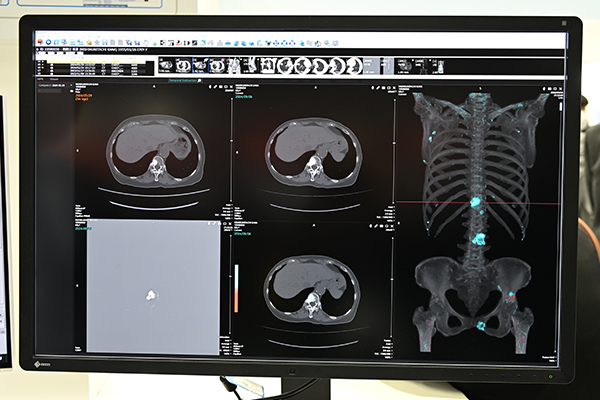 「NOBORI Viewer」から起動した「Temporal Subtraction For Bone(TSB)」 「NOBORI Viewer」から起動した「Temporal Subtraction For Bone(TSB)」