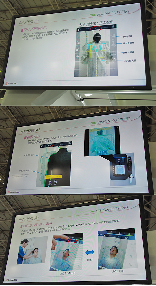 VISION SUPPORTでは,「ライブ映像表示」「体動検出・メッセージ表示」「前回ポジション表示」などの機能によって検査業務をサポート VISION SUPPORTでは,「ライブ映像表示」「体動検出・メッセージ表示」「前回ポジション表示」などの機能によって検査業務をサポート