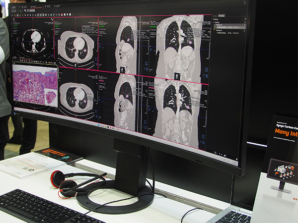 統合型医療情報プラットフォーム「Syngo Carbon」では非DICOM画像も管理・表示可能 統合型医療情報プラットフォーム「Syngo Carbon」では非DICOM画像も管理・表示可能