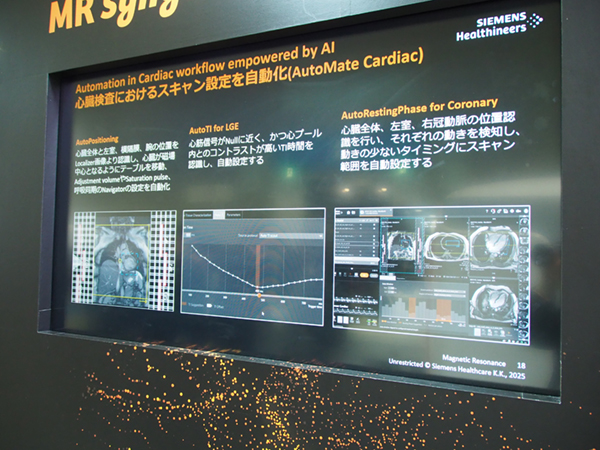 心臓MRIのスキャン設定を自動化しオペーレータの習熟度に依存しない検査を可能とする「AutoMate Cardiac」 心臓MRIのスキャン設定を自動化しオペーレータの習熟度に依存しない検査を可能とする「AutoMate Cardiac」