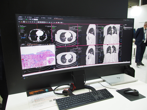 統合型医療情報プラットフォーム「Syngo Carbon」では,あらゆる医療情報データを一元管理可能 統合型医療情報プラットフォーム「Syngo Carbon」では,あらゆる医療情報データを一元管理可能