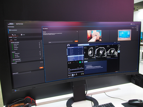 syngo Virtual Cockpitを起動し,遠隔から検査のサポートも可能 syngo Virtual Cockpitを起動し,遠隔から検査のサポートも可能