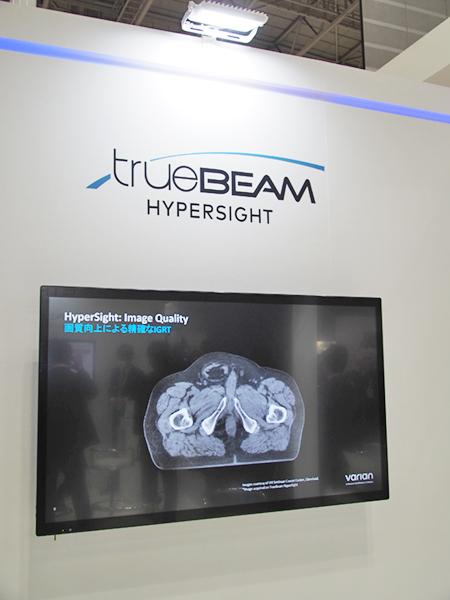「TrueBeam HyperSight」によるCBCT画像例 「TrueBeam HyperSight」によるCBCT画像例