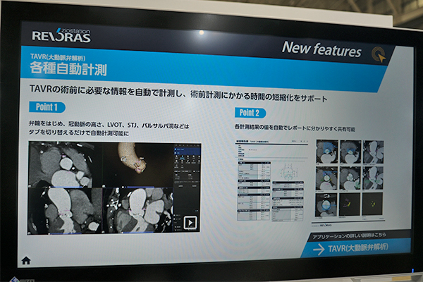 弁輪や冠動脈の高さなどを自動で計測してTAVR術前に必要な情報を提供 弁輪や冠動脈の高さなどを自動で計測してTAVR術前に必要な情報を提供