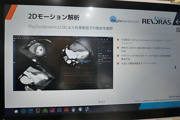 PhyZio/dynamics2.0による2Dモーション解析(W.I.P.) PhyZio/dynamics2.0による2Dモーション解析(W.I.P.)