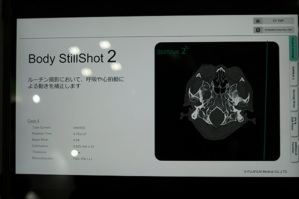 頭部，腹部での動き補正を可能にする「Body StillShot2」