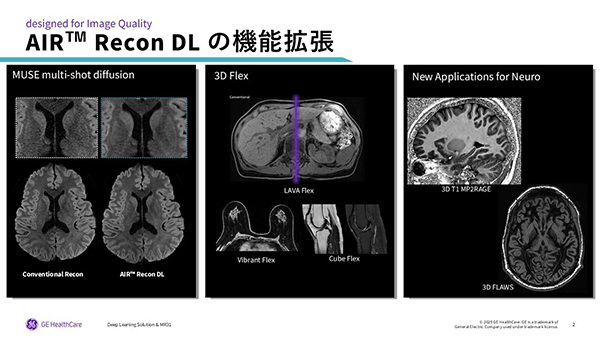 最新バージョン「MR31」における「AIR Recon DL」の拡張