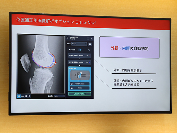 膝関節の側面撮影を支援する位置補正用画像解析ソフトウエア「Ortho-Navi」
