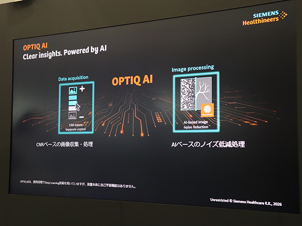 AIを用いた画像再構成技術「OPTIQ AI」の概要