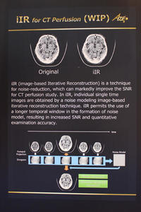 逐次近似画像再構成応用技術「iIR」