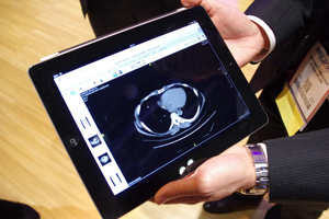 iPadで表示可能なCentricity Universal Viewer zero footprint
