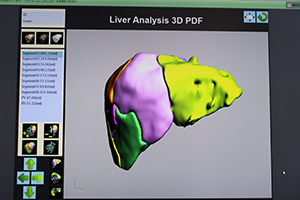 3Dレポーティングで出力したレポート（PDF）