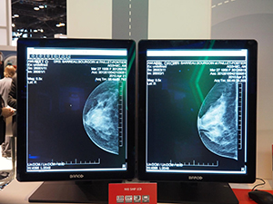 NIO 5MP LEDは省スペースでの設置が可能
