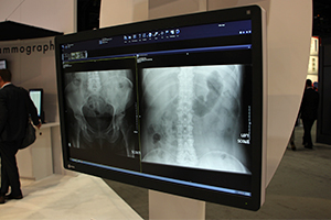 6MPタイプ「RadiForce RX650」