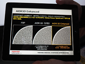 NPSモデルを搭載したAIDR 3D Enhanced