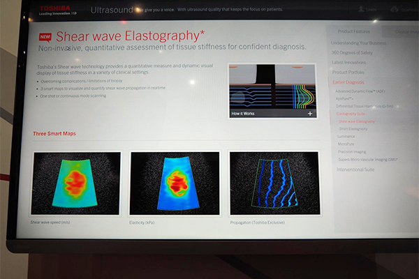 新たなアプリケーションであるShear wave Elastography