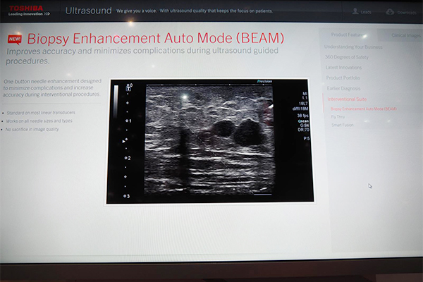 穿刺において針を強調表示するBEAM