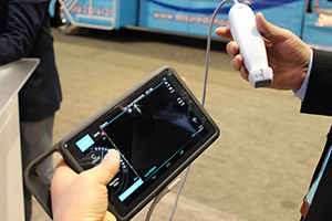 タブレット型のポータブル超音波